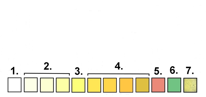 urine-chart1
