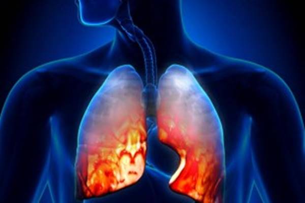 Atípusos megjelenésű invazív meningococcus megbetegedés