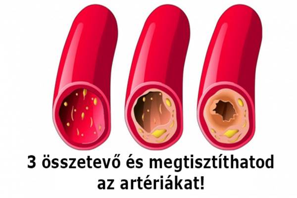 artéria egészség szív természetes)