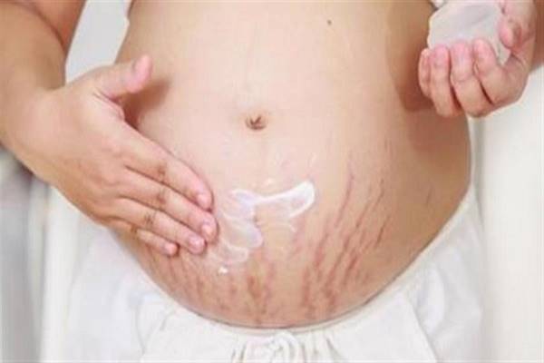 BABE hízás, fogyás, terhességi csíkok elleni krém ml - d
