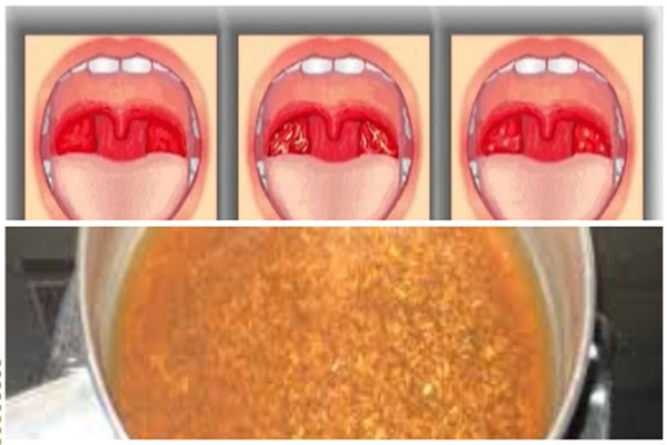 fájdalom a karok és a lábak ízületeiben vitaminok csukló ligamentum sérülése