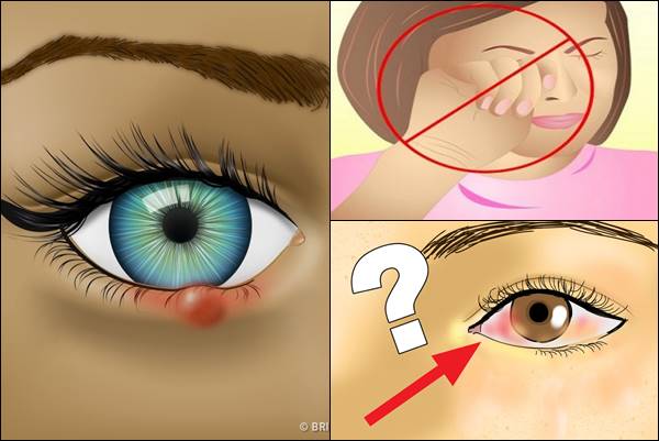 egyik szem homályos látás gennyes betegségek diabétesz kezelésére